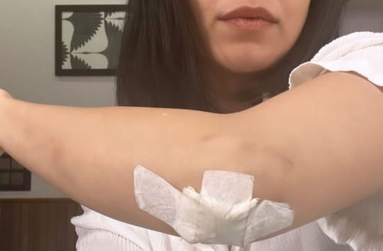 Nushrratt Bharuccha posts, “And the cuts and bruises have begun!! #Chhorii2”!