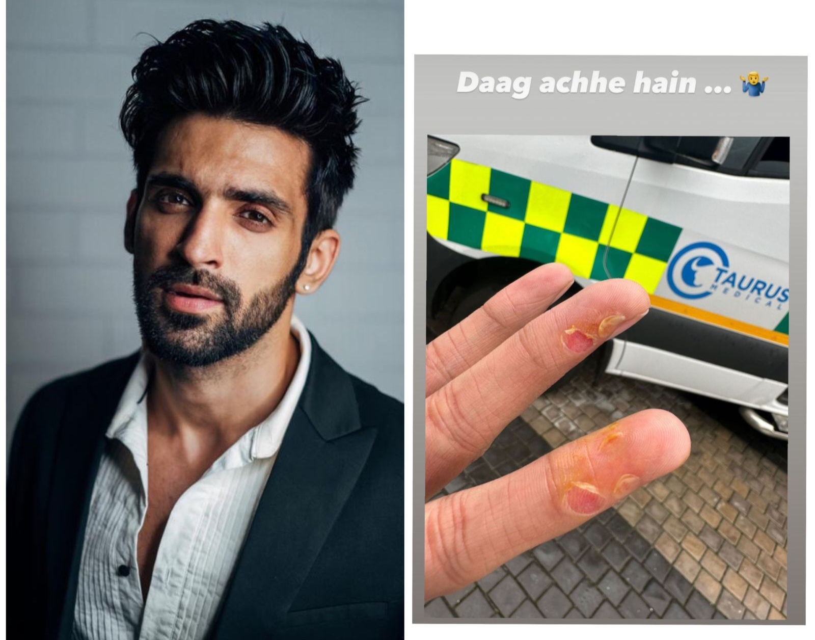 Arjit Taneja hurts his fingers while performing stunts!