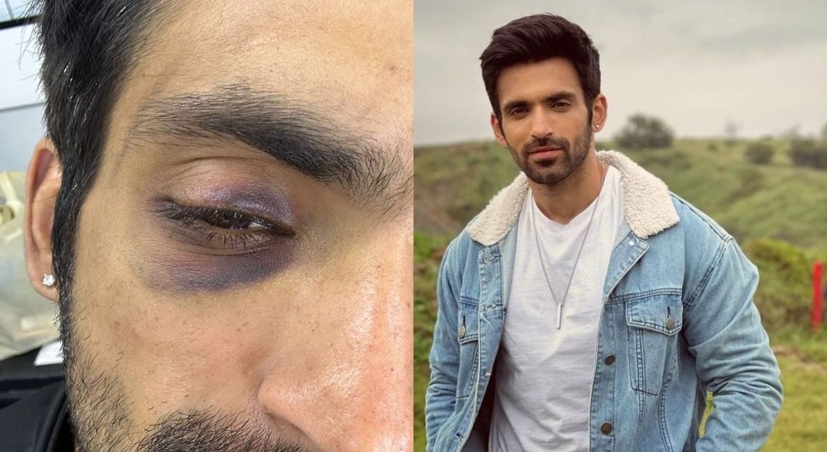 Arjit Taneja gets injured during a high-performance task in KKK!